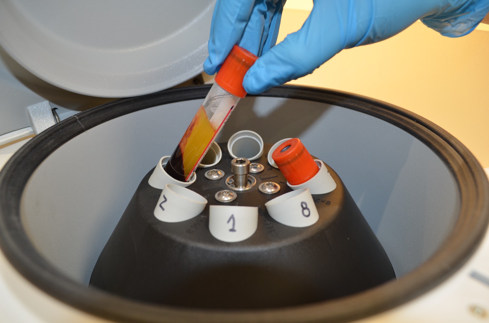 Centrifuga medicina regenerativa